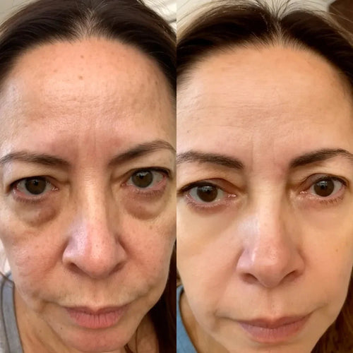 99Glow Bright Eyes™ | Red Light Under-Eye Glasses for Brighter, Rested-Looking Eyes