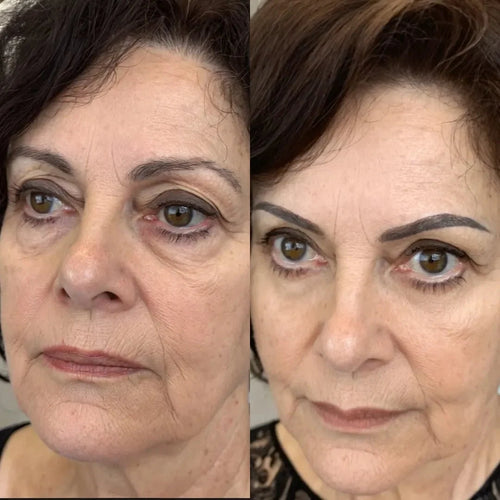 99Glow Bright Eyes™ | Red Light Under-Eye Glasses for Brighter, Rested-Looking Eyes